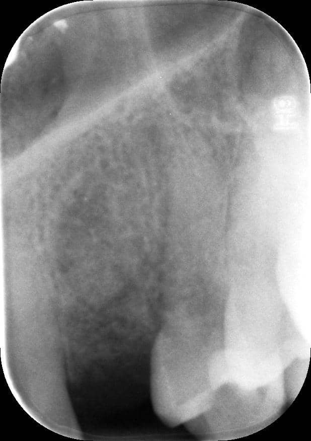 5,1 NOVIA^GIOVANNA_005 10-10-17